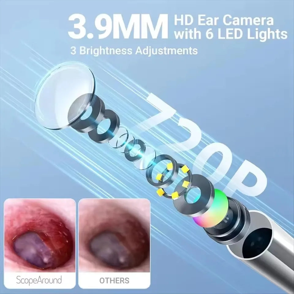 TESLONG Digital Otoscope 