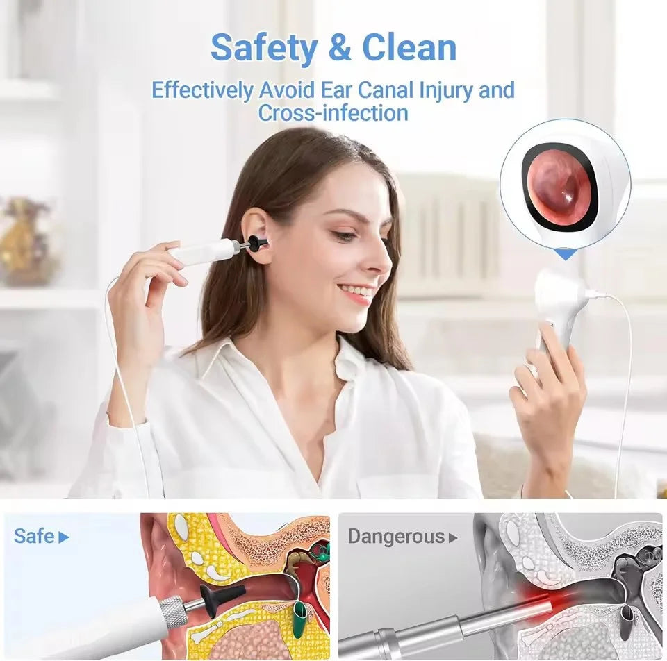 TESLONG Digital Otoscope 